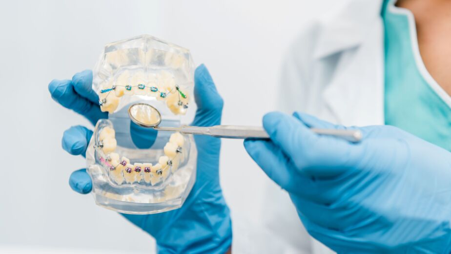 orthodontics-braces-model-birgul-klinik