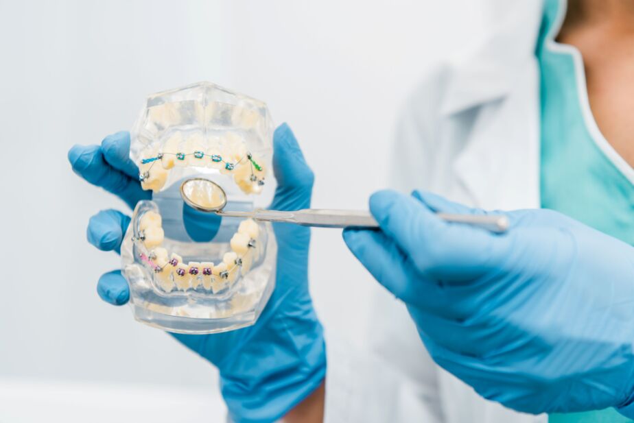 orthodontics-braces-model-birgul-klinik