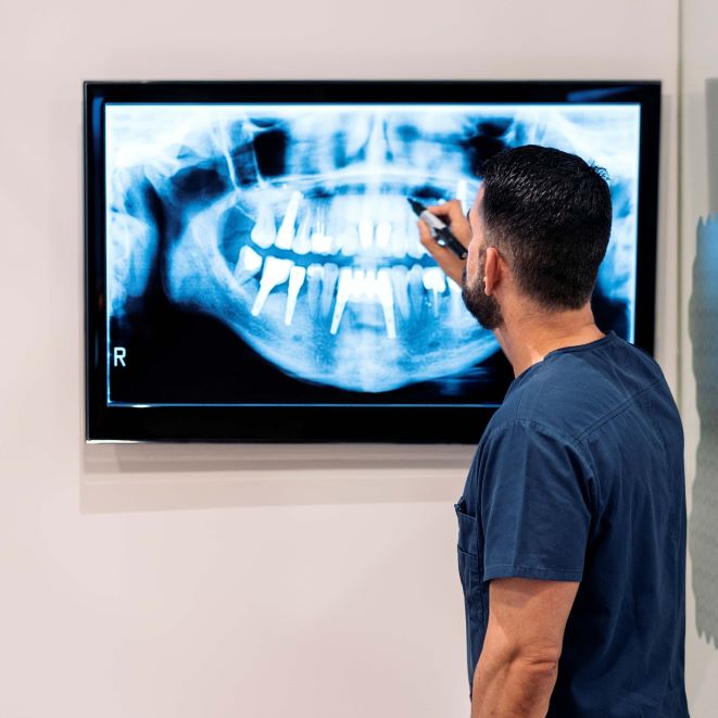 dental implants in Istanbul x-ray consultation