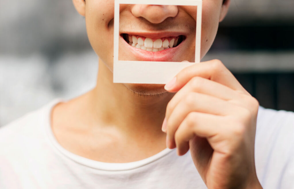 تجميل الابتسامة ودليلها من الزرع حتى التقويم