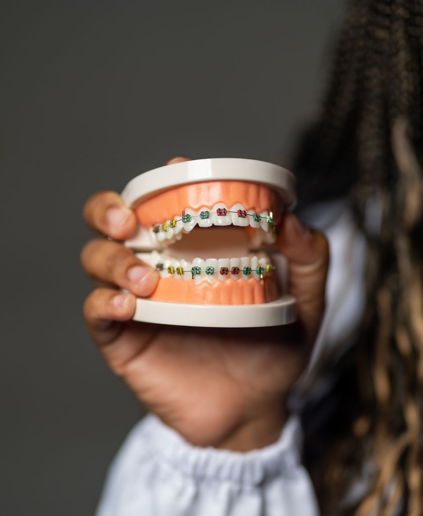 Orthodontics in Istanbul – Braces model