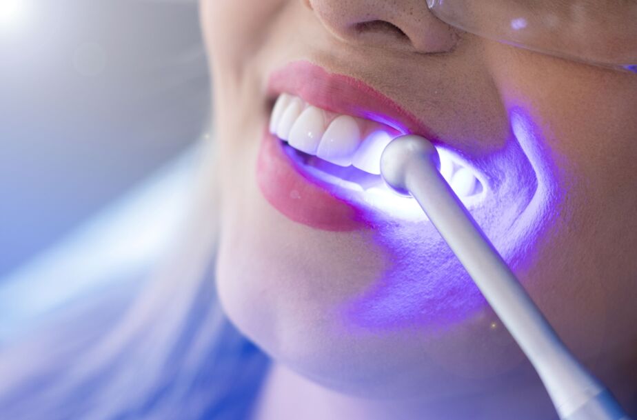 Teeth whitening Turkey with blue LED light