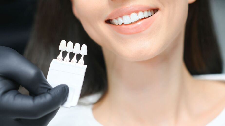 hollywood-smile-cost-turkey-hero