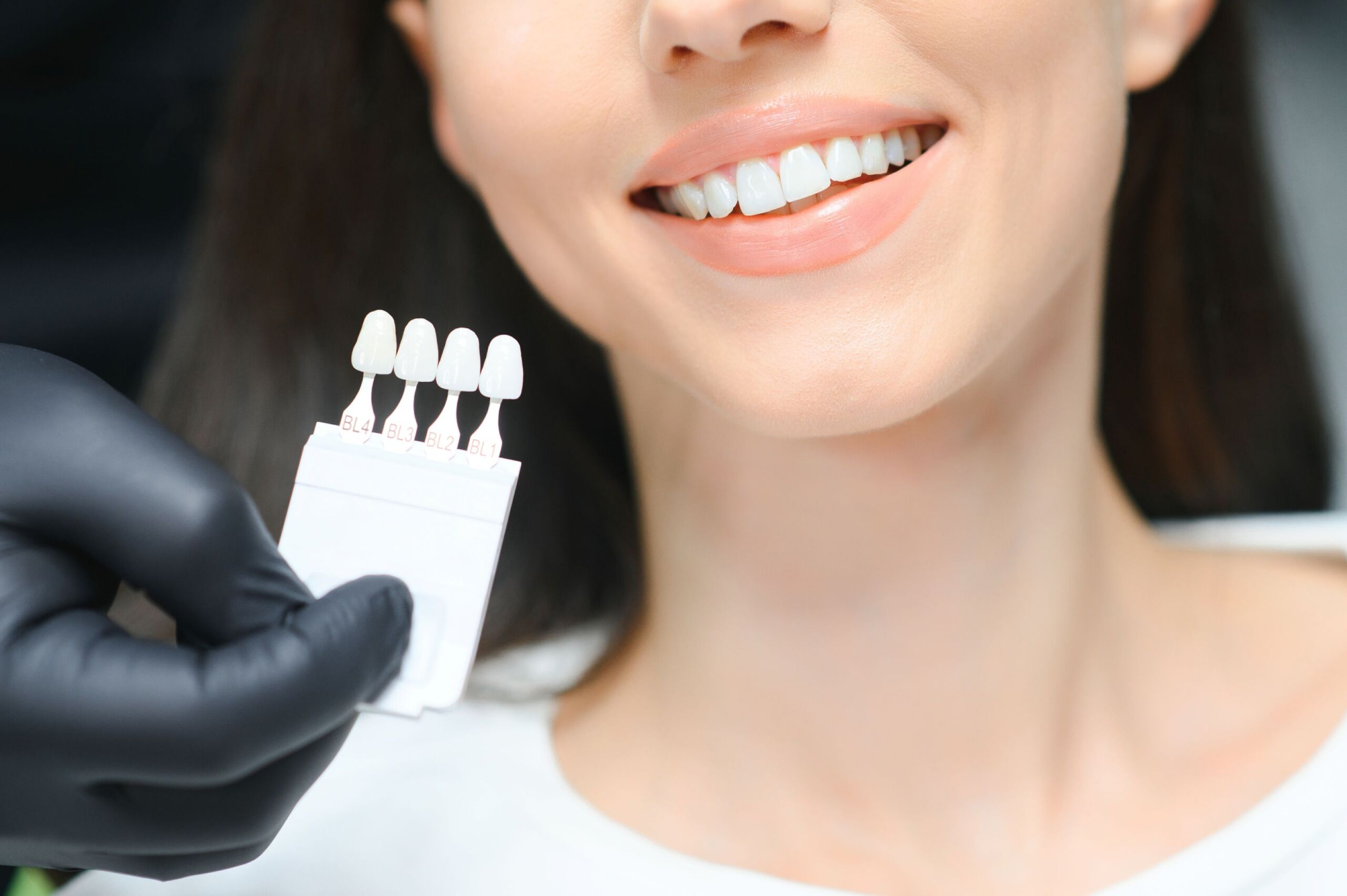 hollywood-smile-cost-turkey-hero