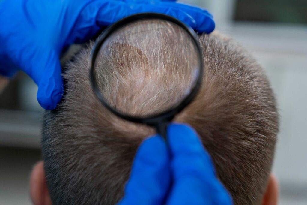 Doctor examining scalp before DHI vs FUE hair transplant