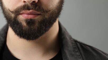 Beard transplant timeline example showing a dense, well-groomed beard on a man’s lower face, highlighting beard shape and thickness.