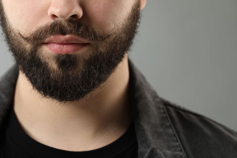 Beard transplant timeline example showing a dense, well-groomed beard on a man’s lower face, highlighting beard shape and thickness.