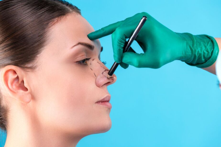 Gloved surgeon using a caliper to measure nasal shape during a pre-rhinoplasty assessment.