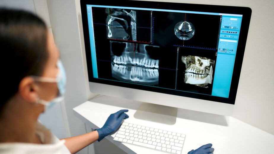 CBCT scan planning for dental implants without bone graft in Turkey