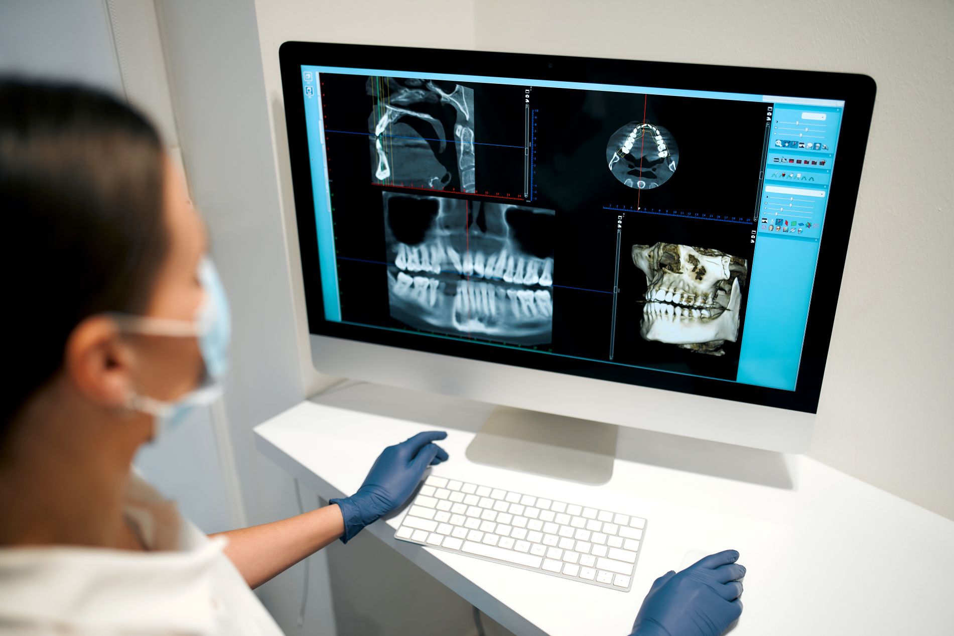 CBCT scan planning for dental implants without bone graft in Turkey