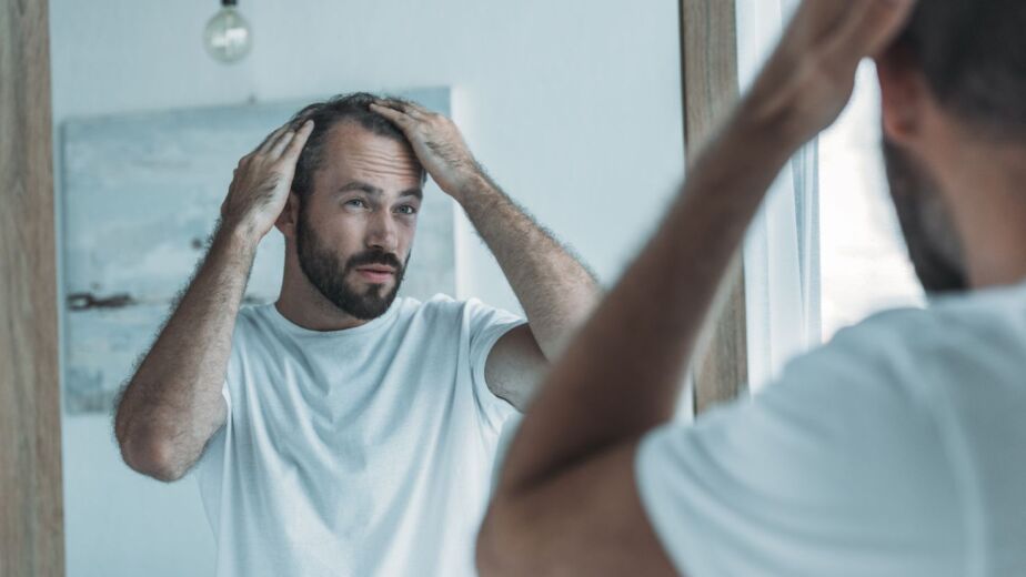 Man checking hair loss in the mirror while researching hair transplant cost in Turkey 2026