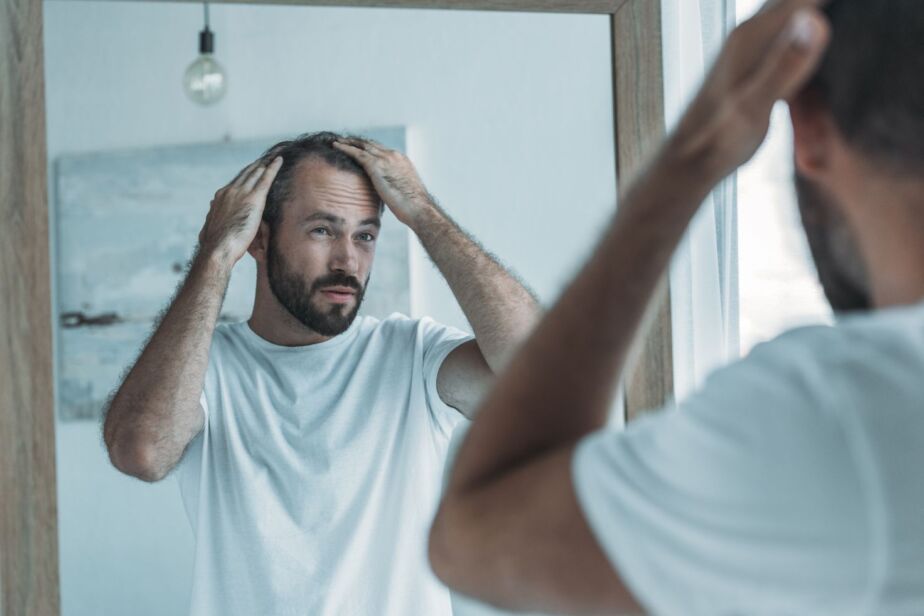 Man checking hair loss in the mirror while researching hair transplant cost in Turkey 2026