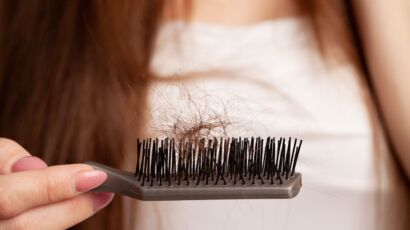 Hair transplant shedding phase: temporary hair shedding after surgery