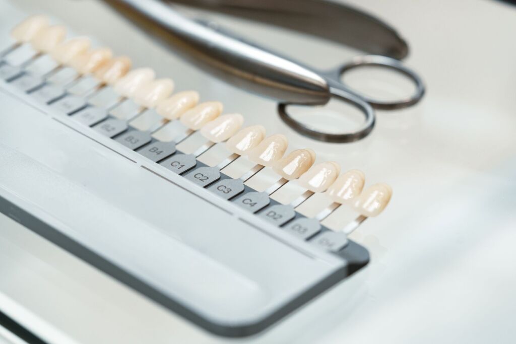 Close-up of dental shade tabs and cosmetic dentistry tools used to assess teeth for veneers
