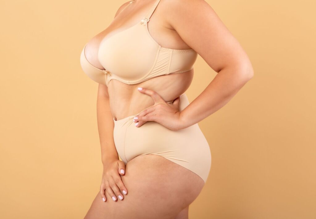 Woman’s torso showing abdomen, waist, and breasts to illustrate procedures included in a mommy makeover