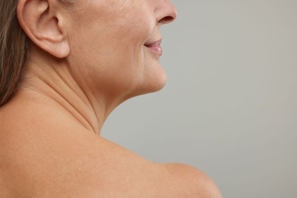 Mature woman with loose neck skin showing neck lift candidate signs