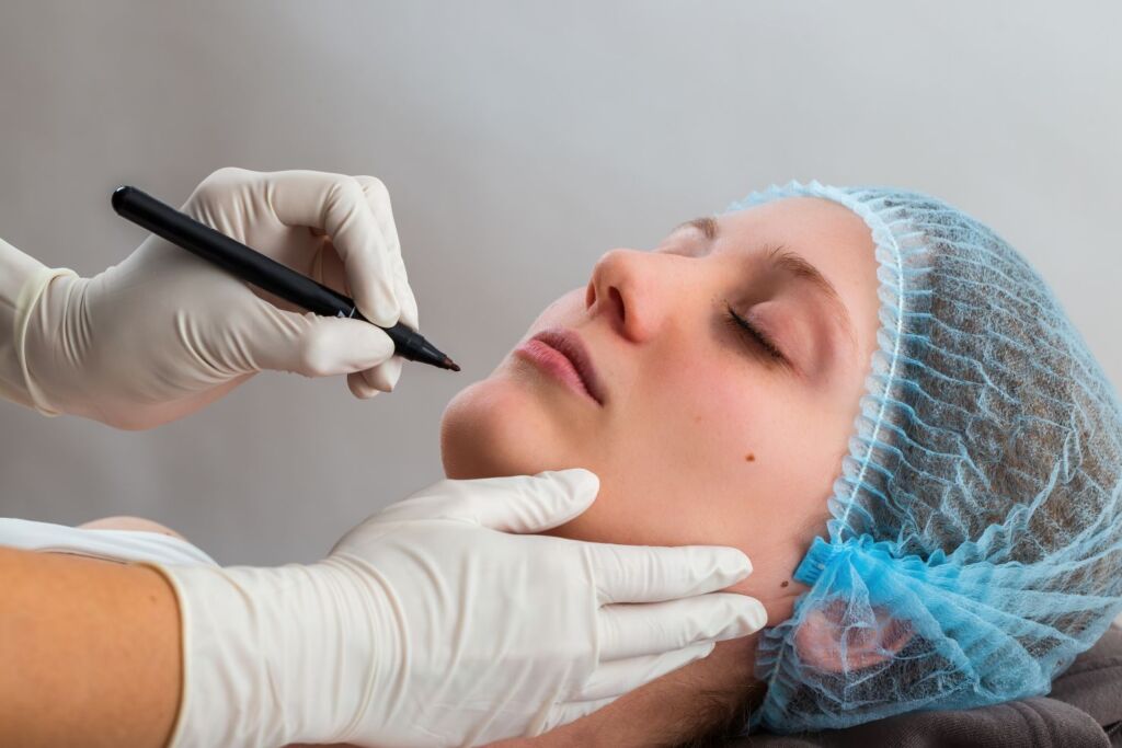 Neck lift surgery planning with surgeon marking the chin and neck area